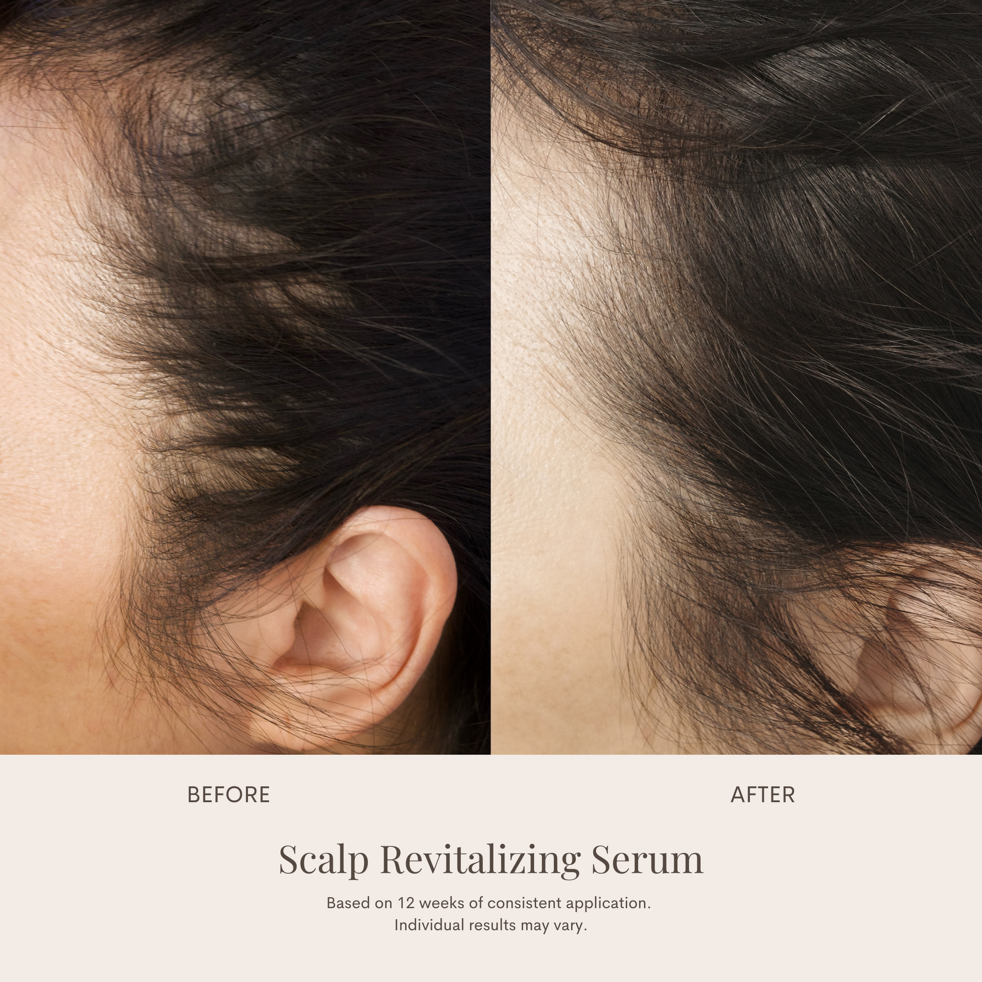 Scalp Revitalizing Serum